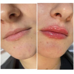 WhatsApp Image 2025-07-04 at 14.44.50